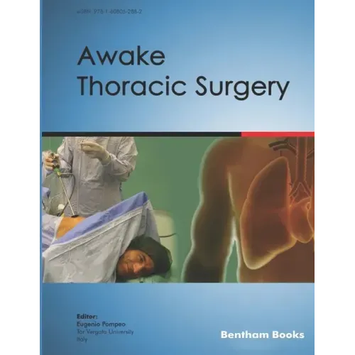 Awake Thoracic Surgery