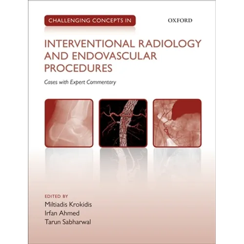 Challenging Concepts in Interventional Radiology