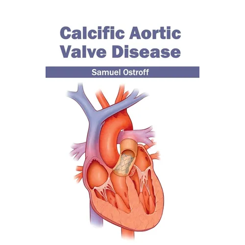 Calcific Aortic Valve Disease
