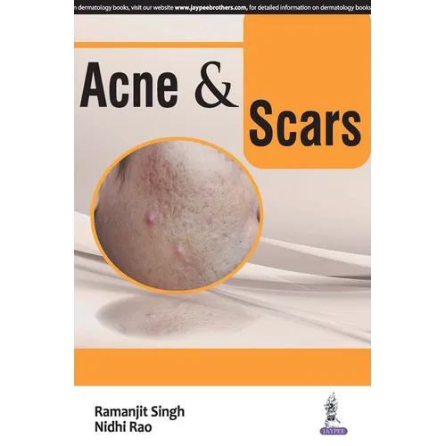ACNE and SCARS