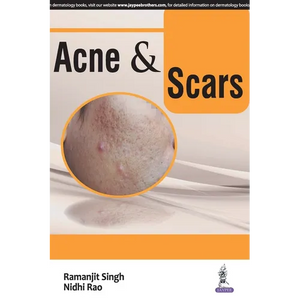 ACNE and SCARS - Paperback