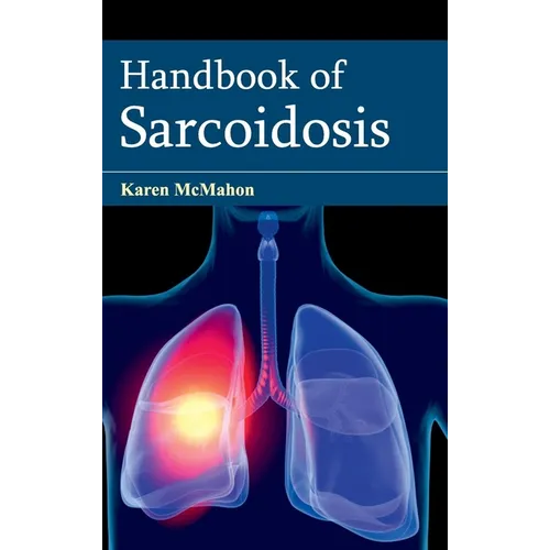 Handbook of Sarcoidosis