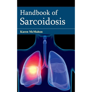 Handbook of Sarcoidosis - Hardcover