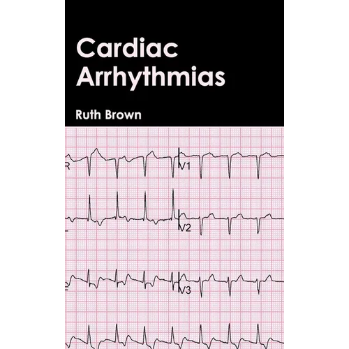 Cardiac Arrhythmias