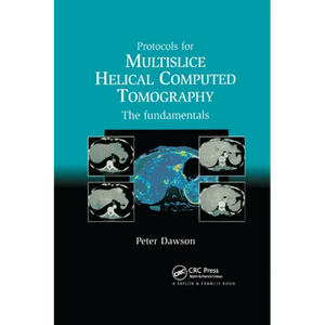 Protocols for Multislice Helical Computed Tomography: The Fundamentals - Paperback