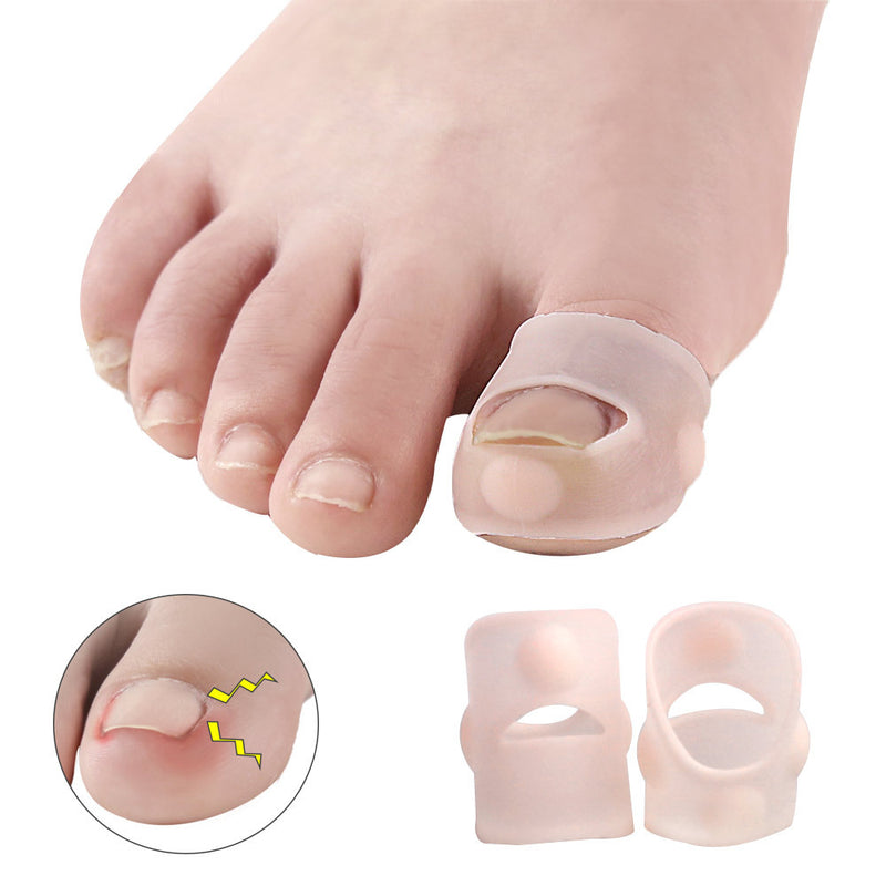 Silicone Inlay Nail Corrector Roll Nail To Correct Nail Pad Nail Groove And Toe To Prevent Nails From Growing Into Flesh